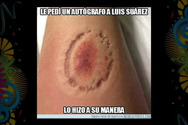 La mordida de Suárez en el Mundial fue objeto de burlas en todo el mundo.