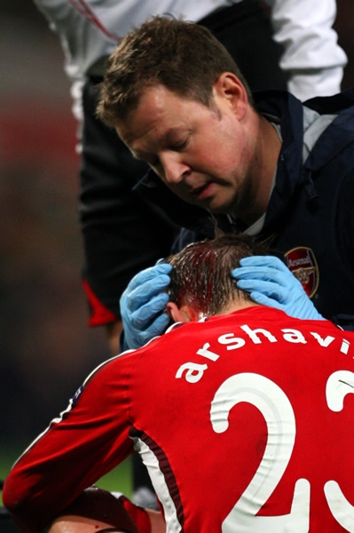 Arsenal-Standard 7