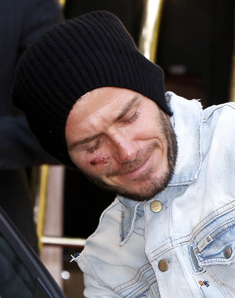 Becks9