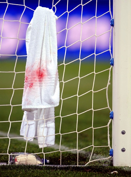 La sangre de un juego heroíco.