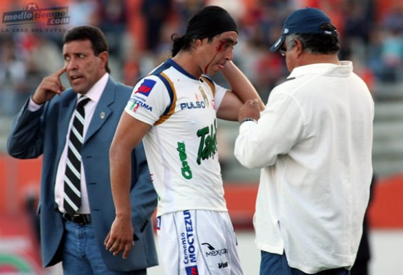 Leonel Olmedo tuvo que ser atendido después de tener abierta la ceja.