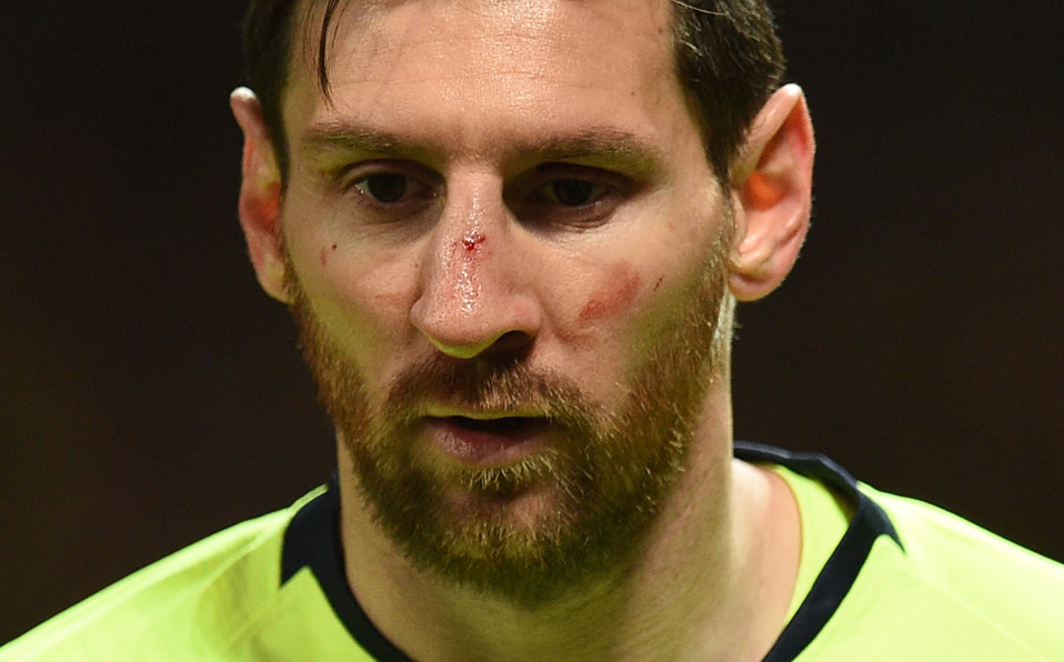 Lio recibió un golpe de Smalling durante el juego de Cuartos de Final de Ida entre United y Barça. (Foto: AFP)