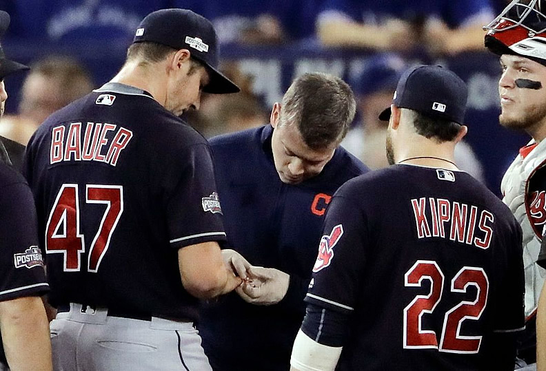 Formas más extrañas en que se han lesionado peloteros de MLB