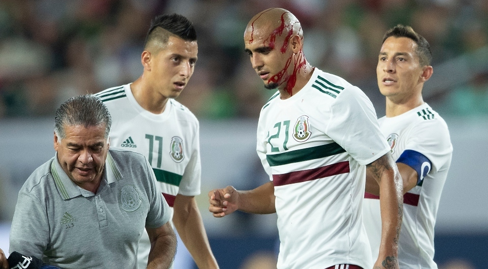haka Rodríguez sufre grave cortada en la cabeza vs Haití. (Foto: Imago7)
