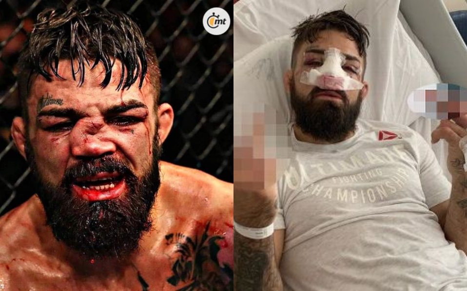 Mike Perry no peleará más en 2019 tras brutal lesión en UFC Uruguay.