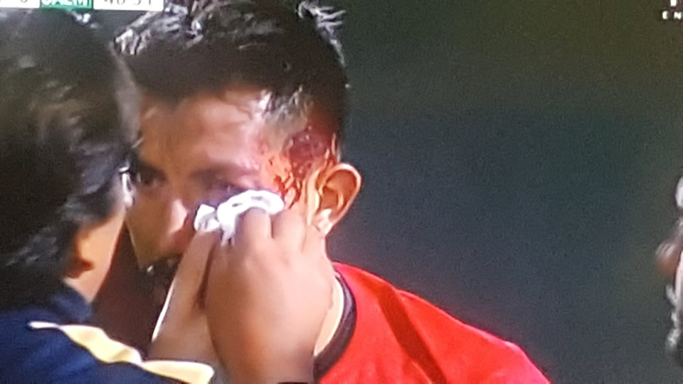 El arquero de Pumas quedó en muy mal estado tras el golpe