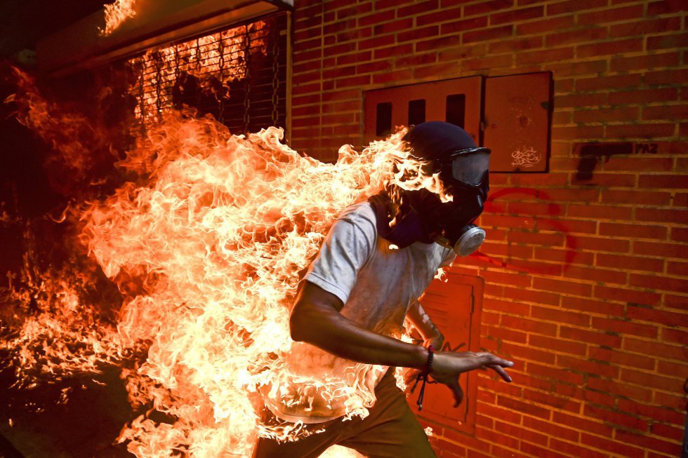 2018 - Crisis en Venezuela (Foto: Ronaldo Schemidt)