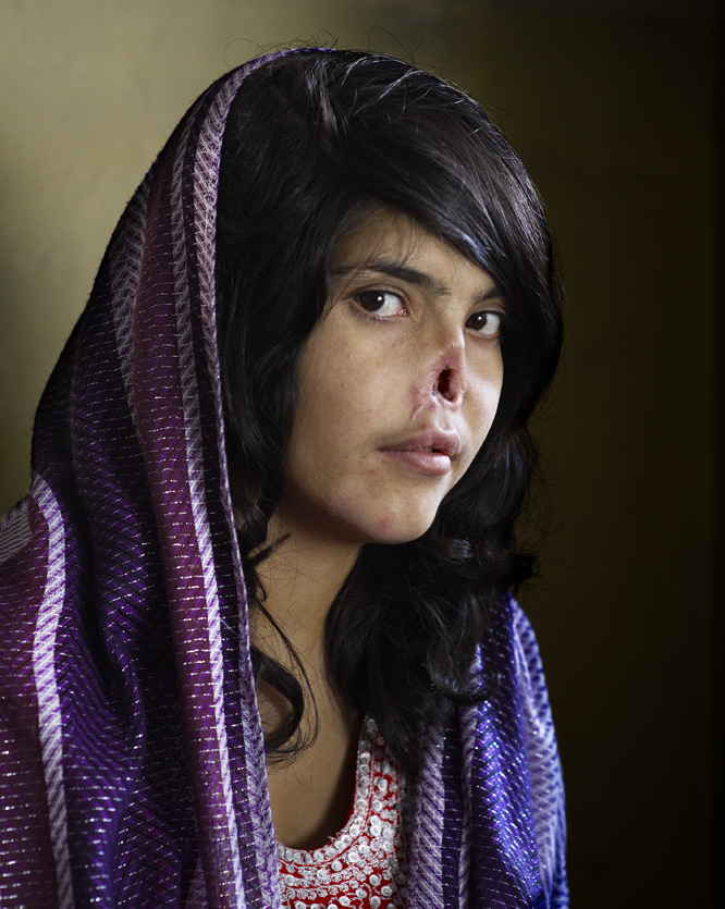 2011- Trato talibán a la mujer (Foto: Jodi Bieber)