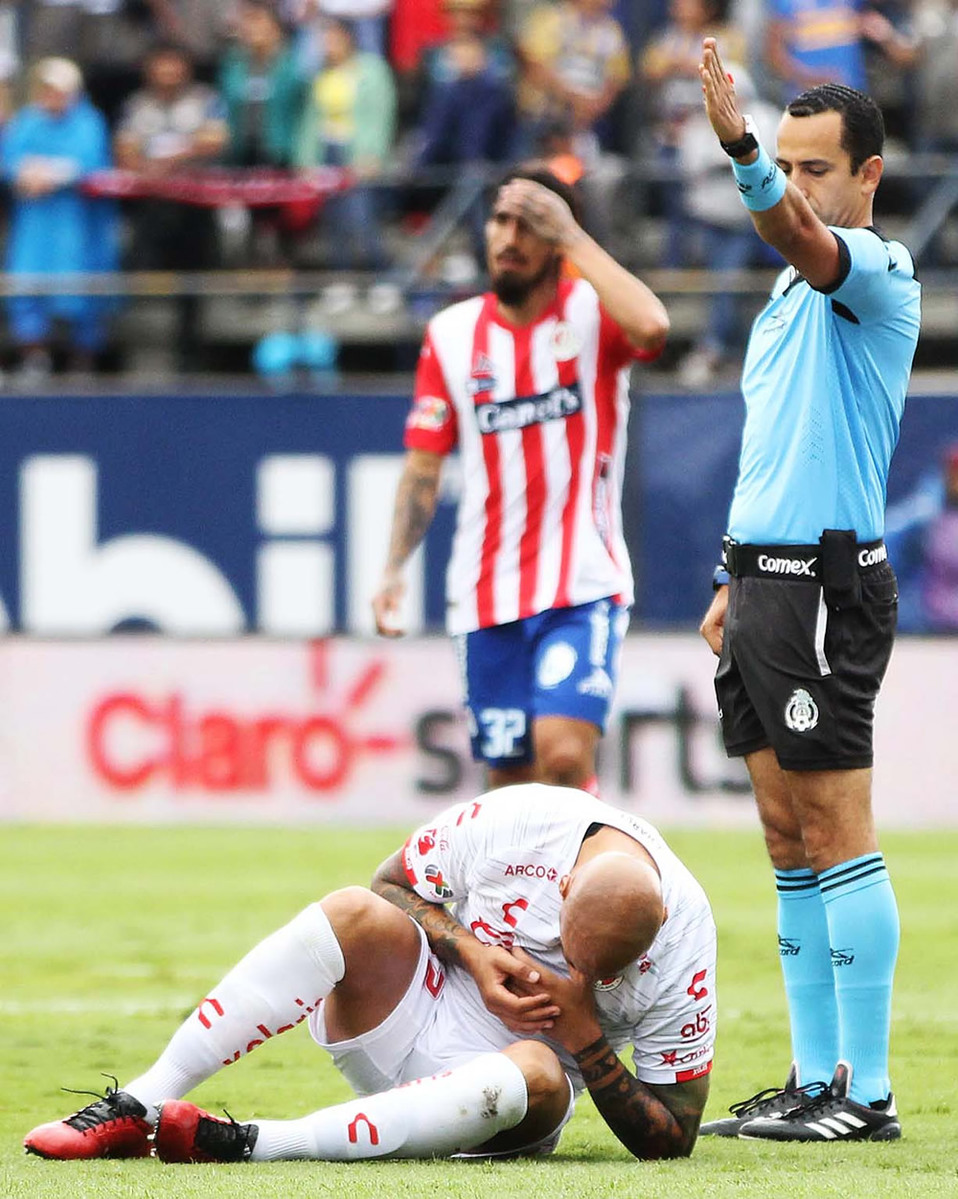 Nahuelpán lastimado en el campo (FOTO: Imago7)