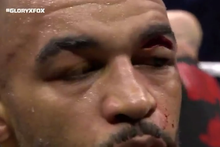 Así quedó Kongolo.