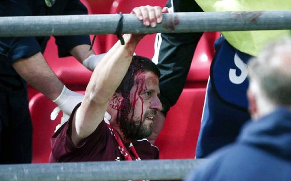 Algunas evidencias de la violencia sufrida por seguidores del Bayern. (Twitter)
