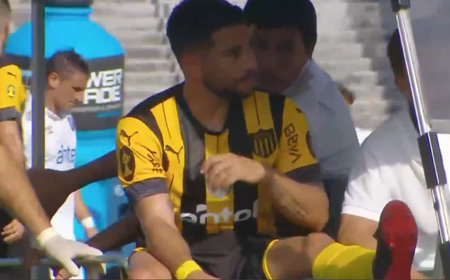 El futbolista charrúa estará fuera de actividad de menos seis meses por la fractura.