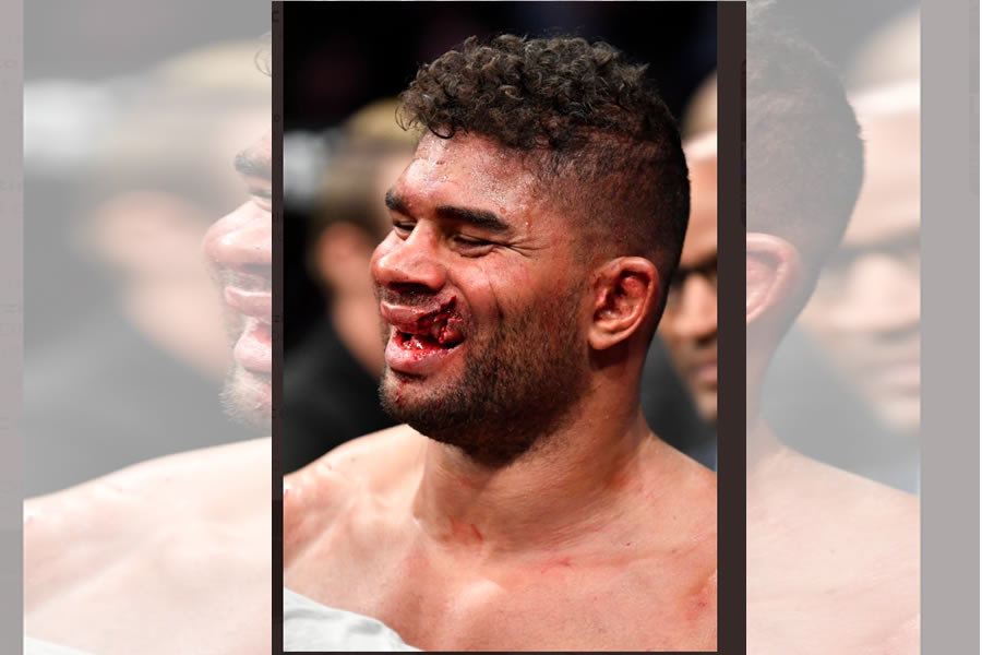 Alistair Overeem no perdió el buen humor pese a la derrota. FOTO: @ufc