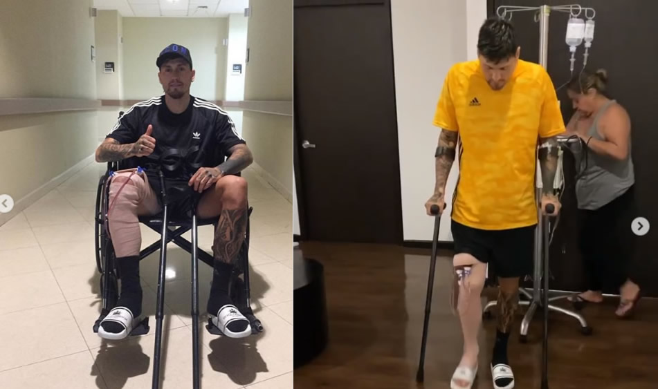 Nico Castillo dejó el hospital tras 12 internado (FOTO: Instagram)