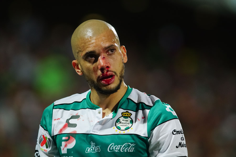 Matheus Doria salió de cambio tras su choque con Félix Torres. (Foto: Imago7)