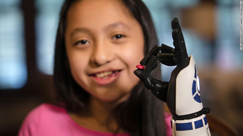 Isabella Tadlock con su brazo biónico llamado R2-D2.
