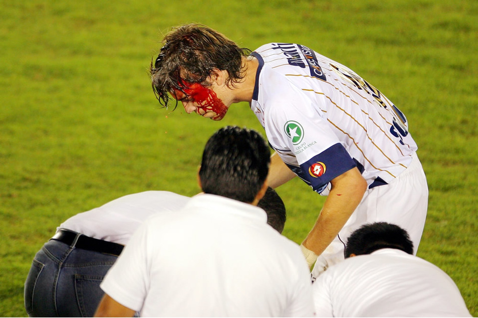 Esteban Solari sufrió una cortada en la cabeza por un codazo que le propinó Muñoz Mustafá (FOTO: Mexsport)