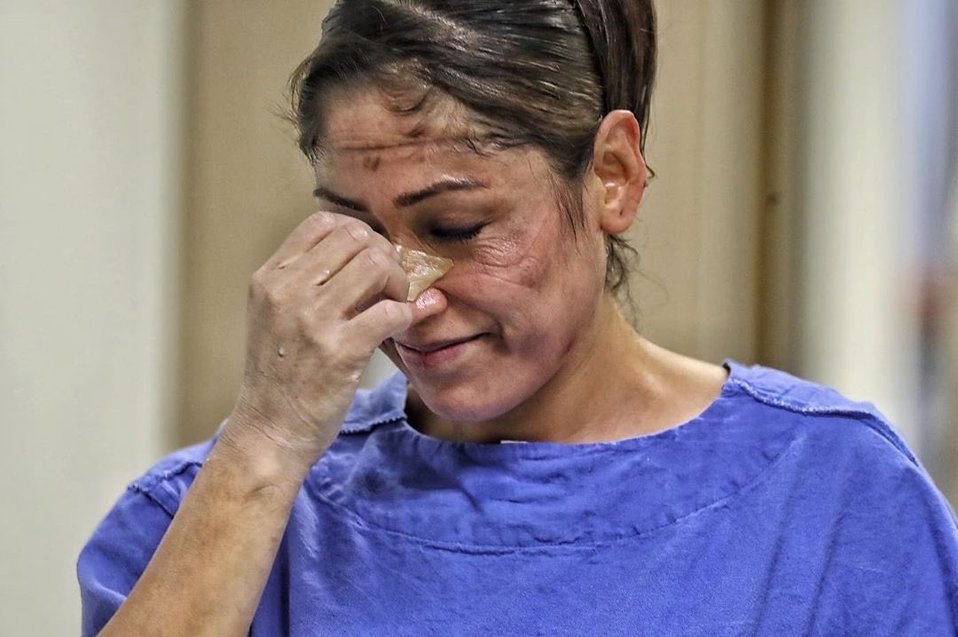 Los lentes y mascarillas que deben utilizar les dejan marcado el rostro (FOTO: La Jornada)