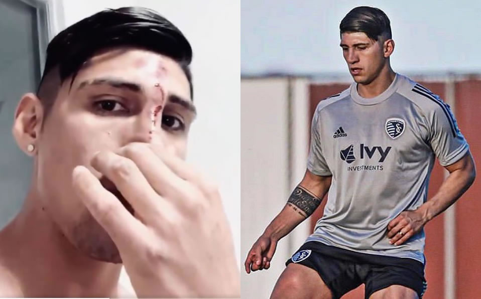 El delantero se accidentó en su casa (Instagram)