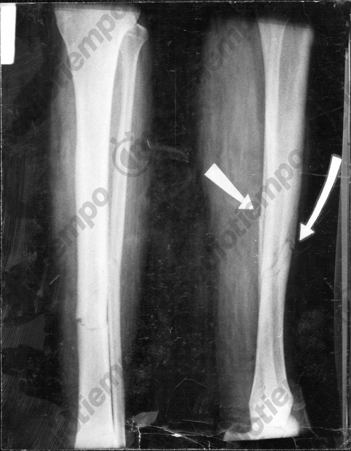 Así fueron las radiografías de la fractura del mediocampista. (Fototeca Milenio)