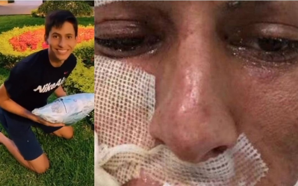 Jürgen Damm 'recrea' su accidente en TikTok y se hace viral