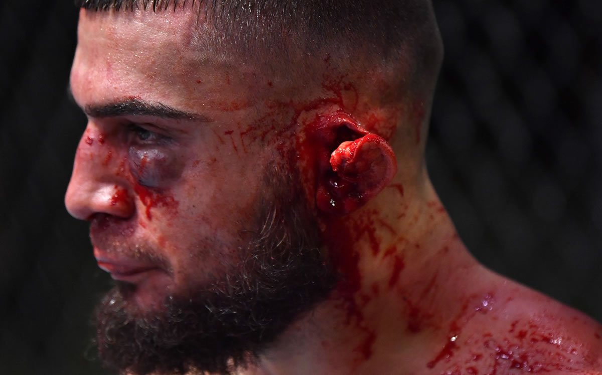 El peleador no pudo continuar en su combate (Cortesía Dana White)