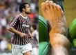Así le quedó el pie a Fred, de 37 años, quien juega en el Fluminense de Brasil. Foto: AFP/Instagram Fred Guedes
