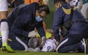 El jugador de Pumas está fuera de peligro, pero en observación. (Foto: Mexsport)