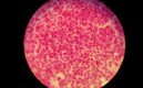 Una imagen microscópica de la bacteria que produce la gonorrea. Foto: Especial
