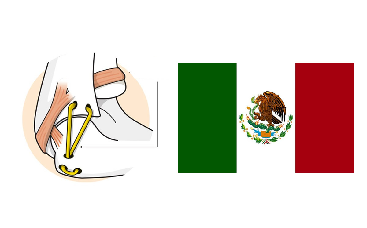 MLB: Pitchers mexicanos que se sometieron a la 'Tommy John'