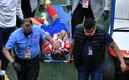 Así salió el Chicote Calderón del Clásico Nacional. Foto: Imago7