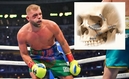 Billy Joe Saunders acabó con la mejilla destrozada ante Canelo Álvarez