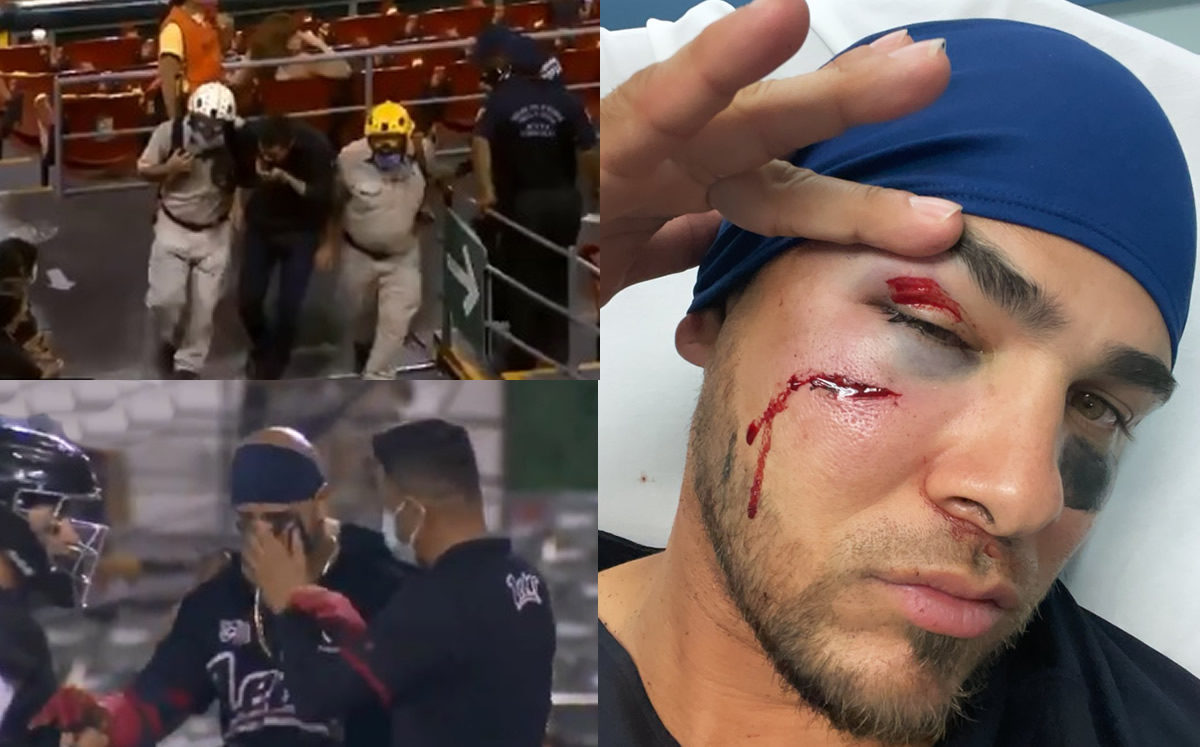 ¡DRAMÁTICO! Fan y pelotero son golpeados en la cara en el mismo inning