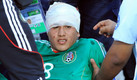 Julio Gómez se ganó el apodo de Momia en el México-Alemania Sub-17 del 2011. (Mexsport)