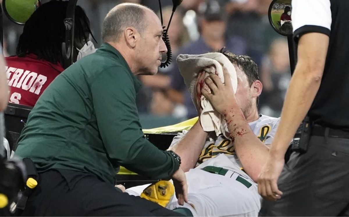 Chris Bassitt tuvo que salir en el carrito de las asistencias médicas. (AP)