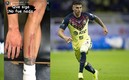 Así quedó la pierna de Jorge Sánchez tras el Clásico. Foto: Imago7