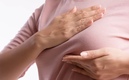 El cáncer de mama es una enfermedad muy común en México. (Foto: AP)