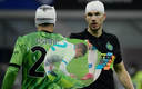 David Ospina y Edin Dzeko pudieron seguir jugando pese al choque de cabezas. (AFP)