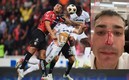 Dinenno publicó cómo quedó su rostro tras el golpe. Foto: Mexsport / Dinenno