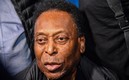 Pelé sigue su tratamiento contra un tumor. Foto: AFP
