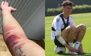 Igor sufrió la fuerte herida en su brazo. (Foto: Tigres)