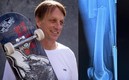 Tony Hawk mostró la radiografía de su fractura de fémur.