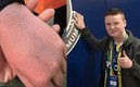 Así terminó la mano del niño dueño del celular que tiró Cristiano.