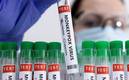 Europa concentra la mayoría de casos de viruela del mono con 191 (Reuters)