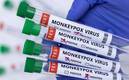 Se detectó el primer caso de viruela del mono en México (Reuters)