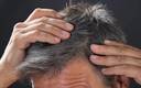 ¿El estrés tiene que ver con la aparición del cabello gris?
