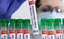 La Viruela del Mono aún no es una emergencia sanitaria, declaró la OMS (Reuters)