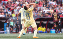 América perdió ante Tijuana. (Foto: Imago7)
