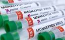En México se han confirmado 60 positivos por viruela del mono (Reuters)