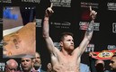 En días pasado el Canelo mostró las cicatrices de su cirugía. Foto: (Imago7)
